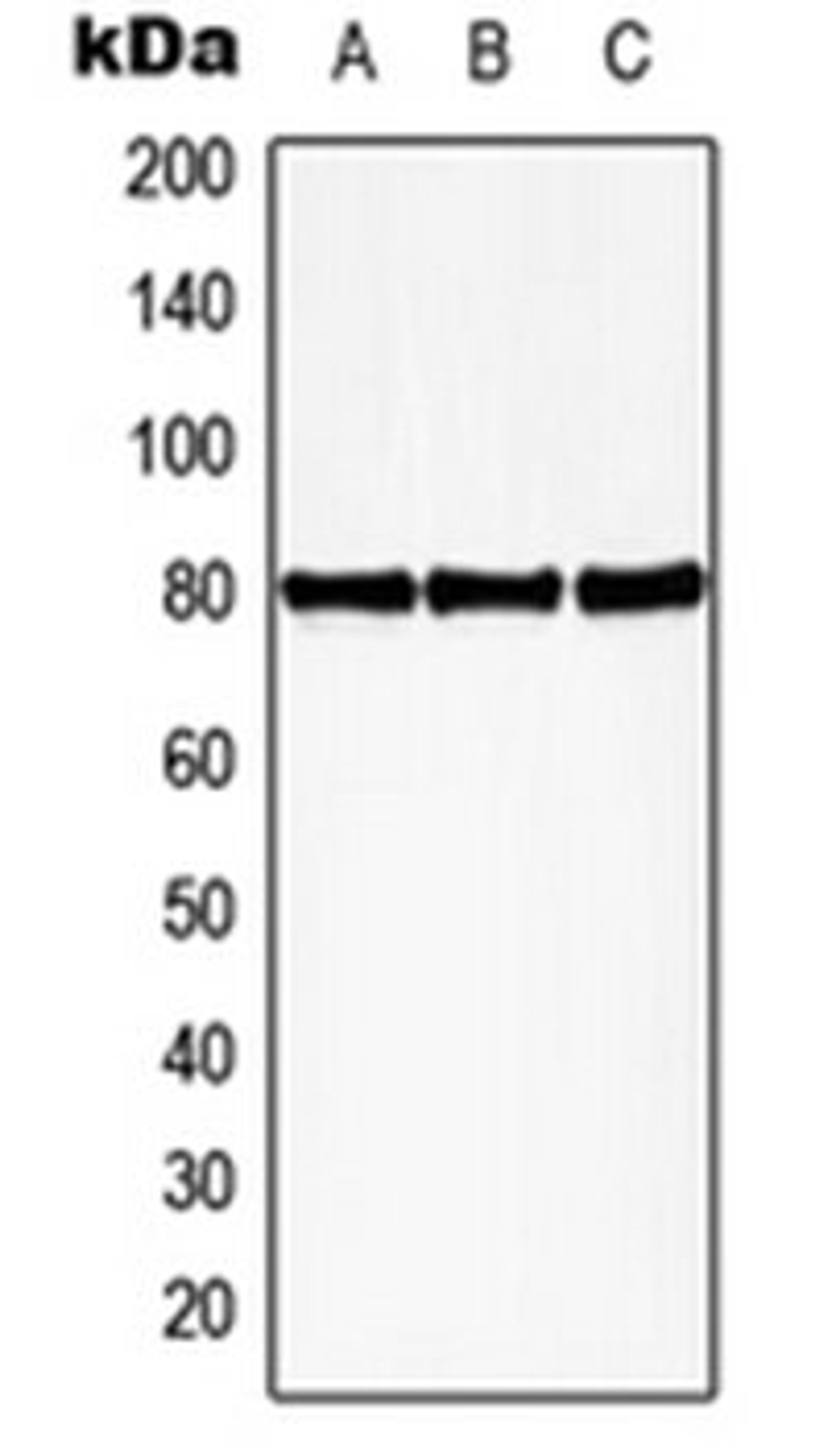 Western blot analysis of HEK293T PMA-treated (Lane 1), mouse spleen (Lane 2), rat spleen (Lane 3) whole cell lysates using HBP1 antibody