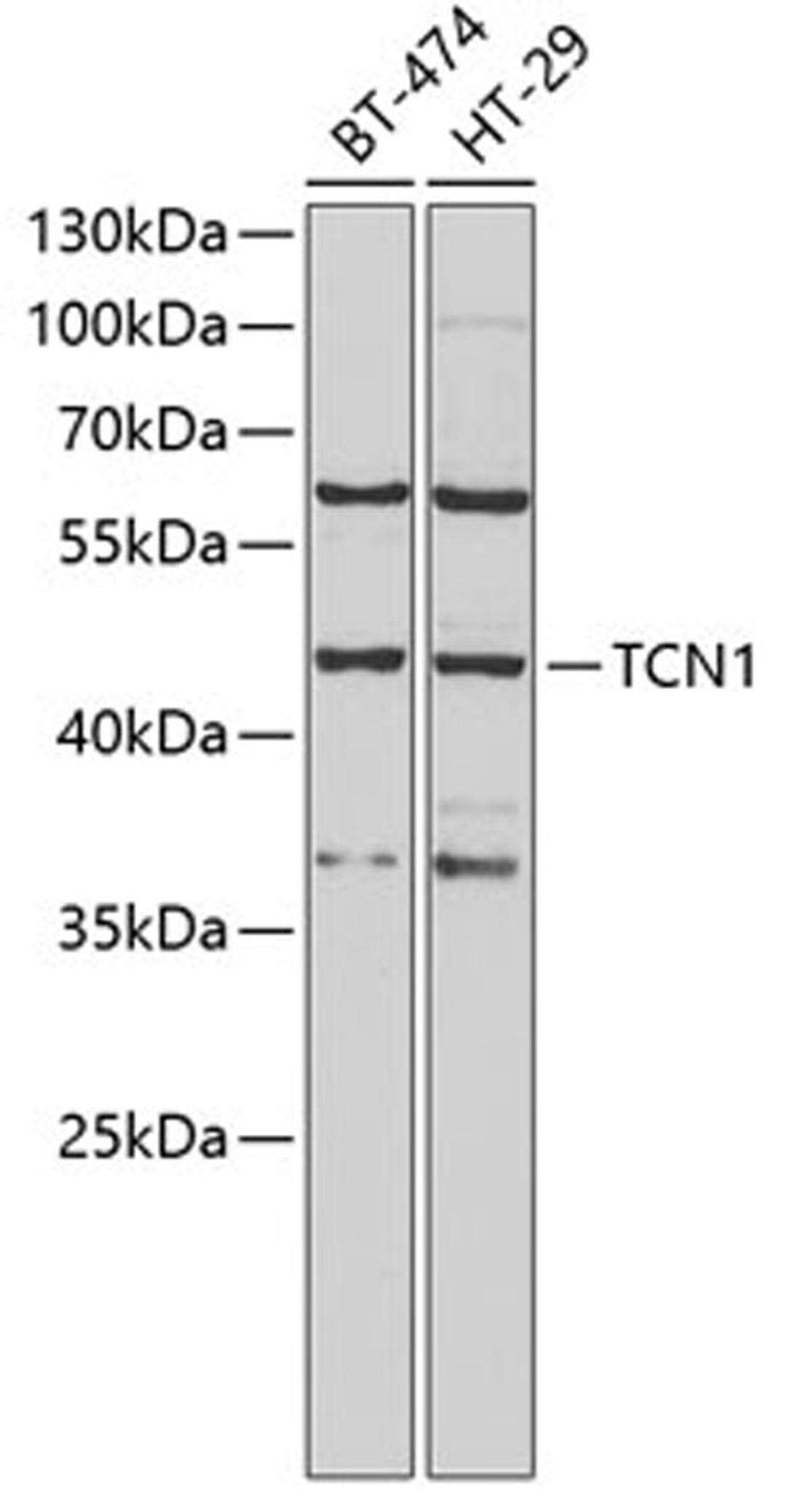 Western blot - TCN1 antibody (A6414)