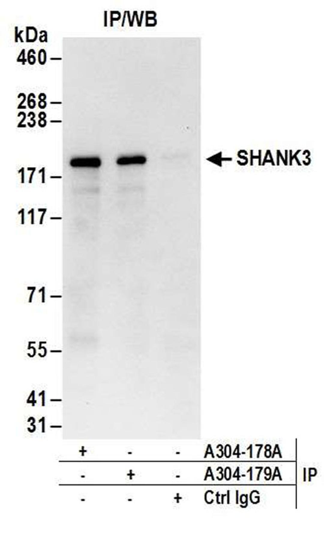 Detection of human SHANK3 by WB of IP.