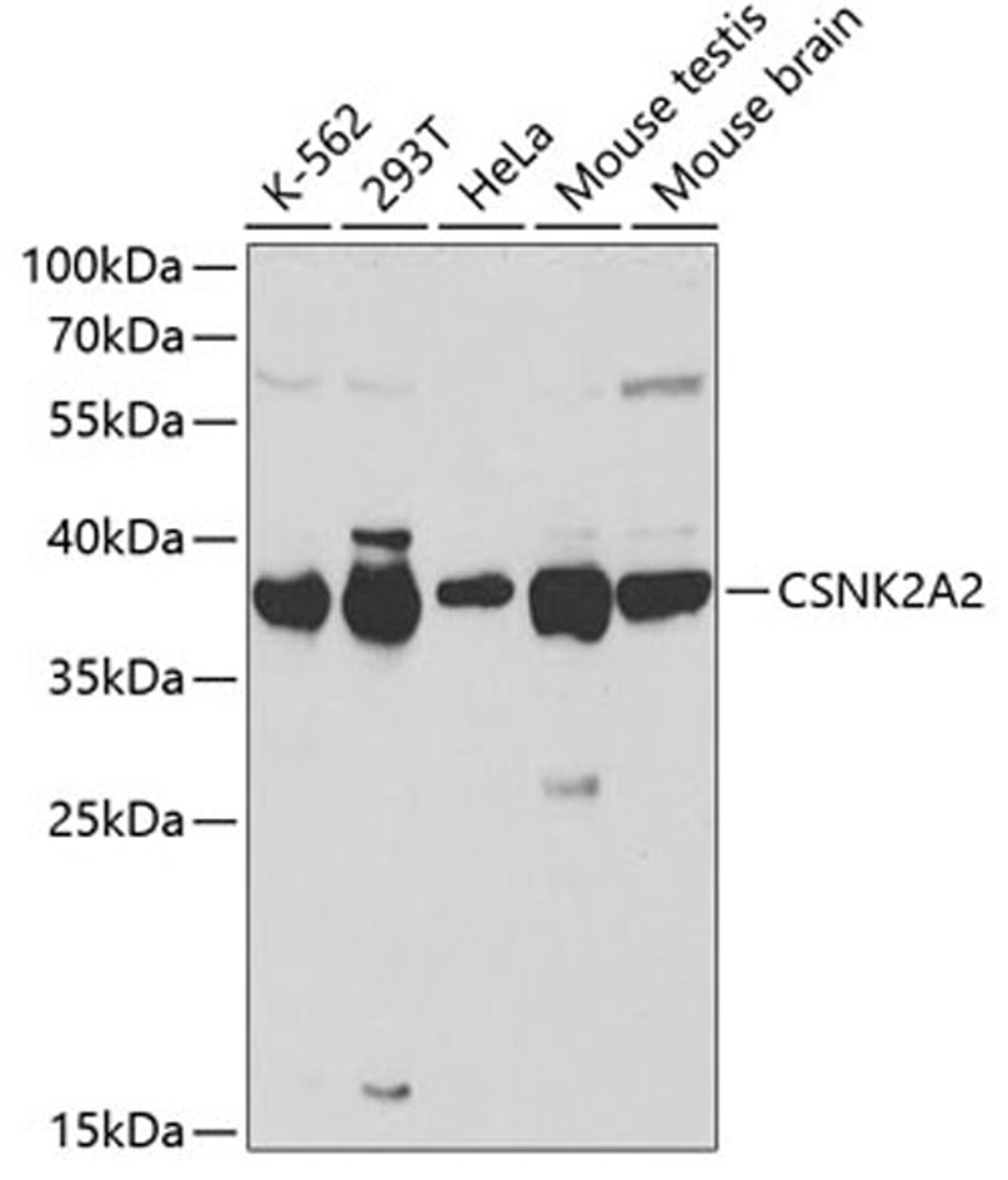 Western blot - CSNK2A2 antibody (A1616)