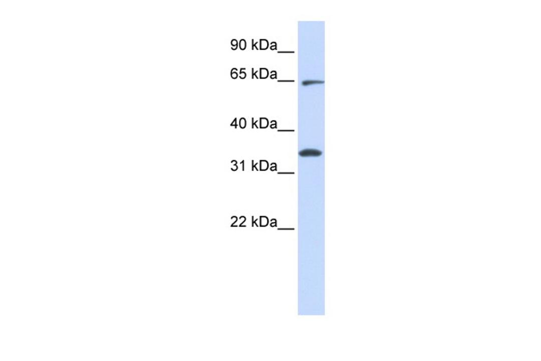 Antibody used in WB on Human HeLa at 0.2-1 ug/ml.