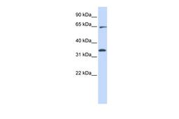 Antibody used in WB on Human HeLa at 0.2-1 ug/ml.