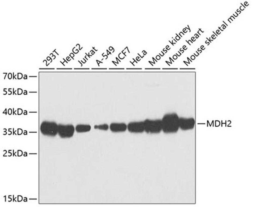 Western blot - MDH2 antibody (A13516)