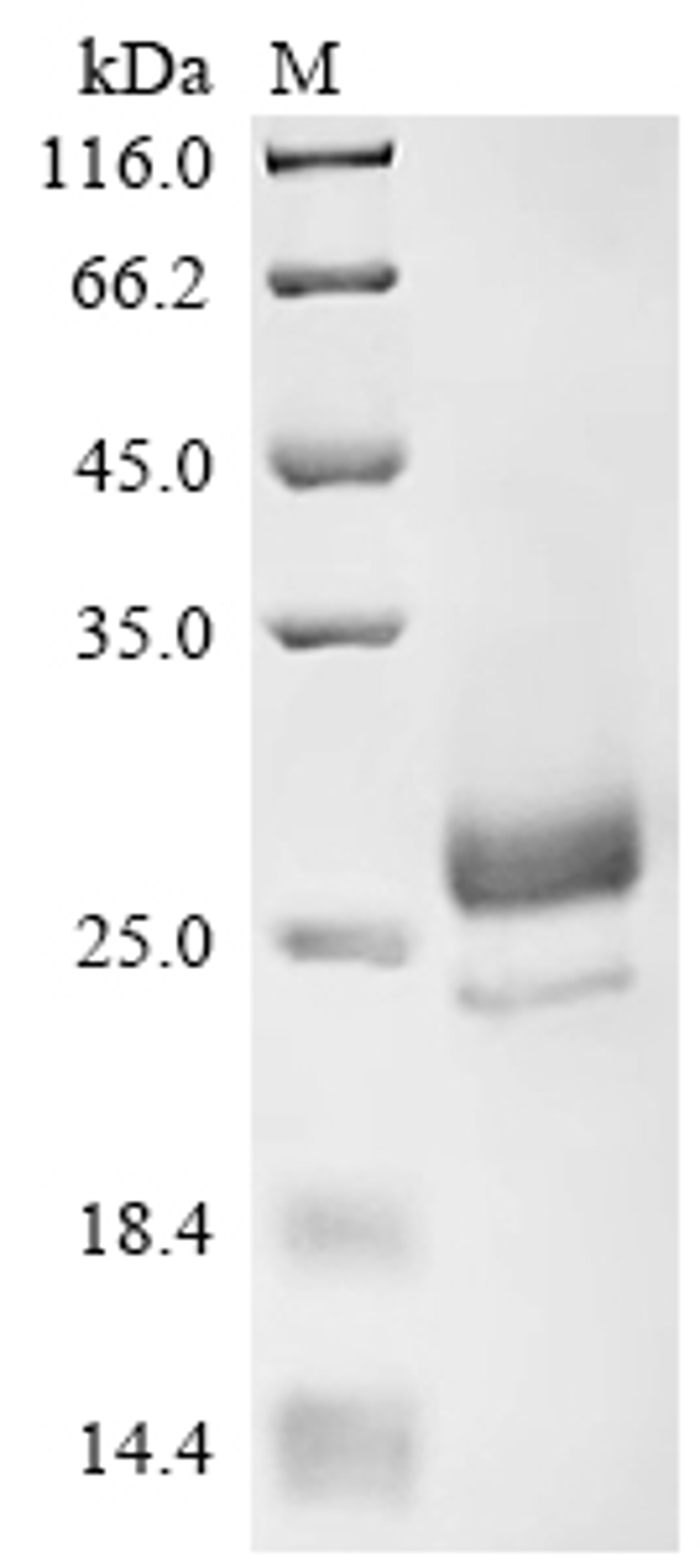 (Tris-Glycine gel) Discontinuous SDS-PAGE (reduced) with 5% enrichment gel and 15% separation gel.