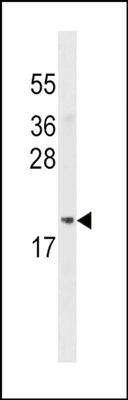 Western blot analysis in MDA-MB453 cell line lysates (35ug/lane).