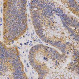 Immunohistochemistry - P2RY11 antibody (A3061)