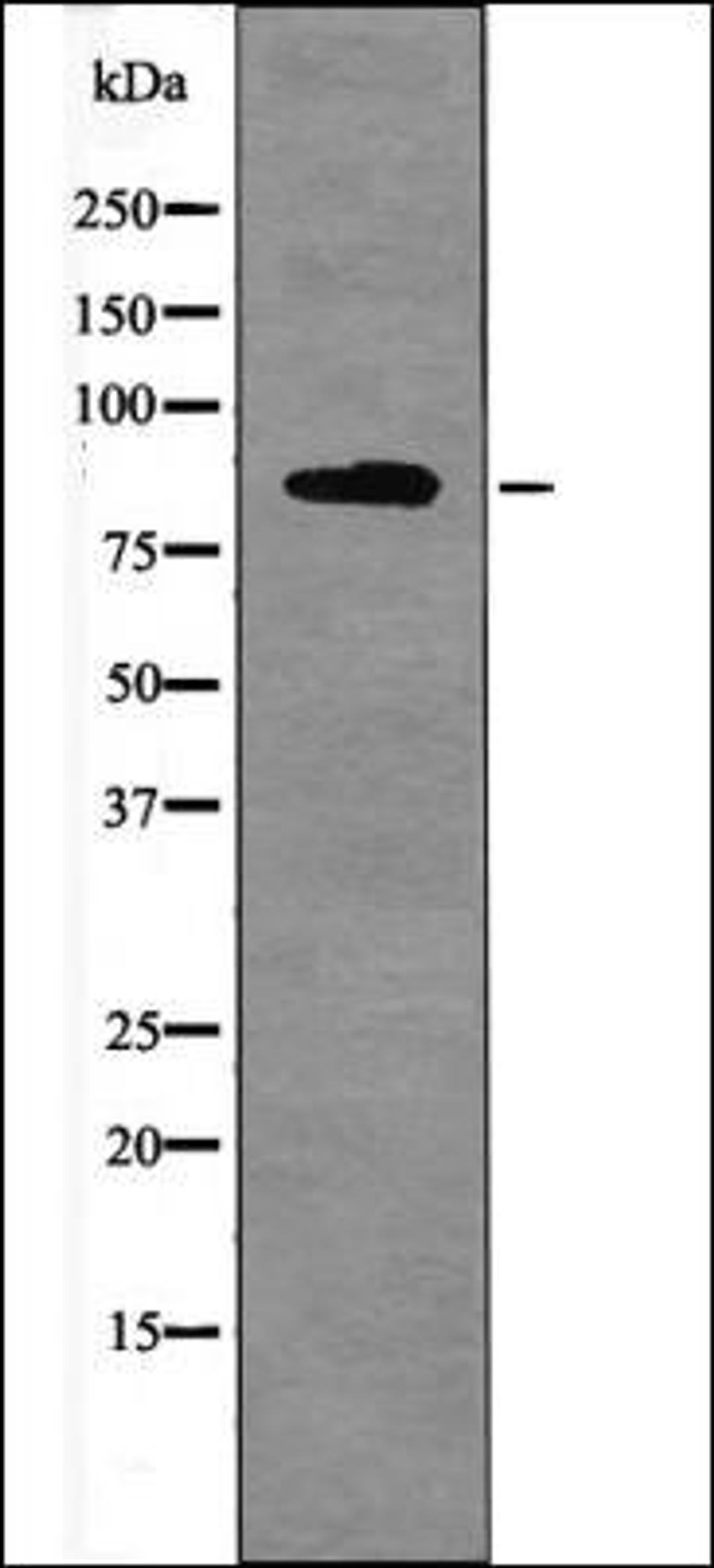 Western blot analysis of PMA treated NIH-3T3 whole cell lysates using FER -Phospho-Tyr714- antibody