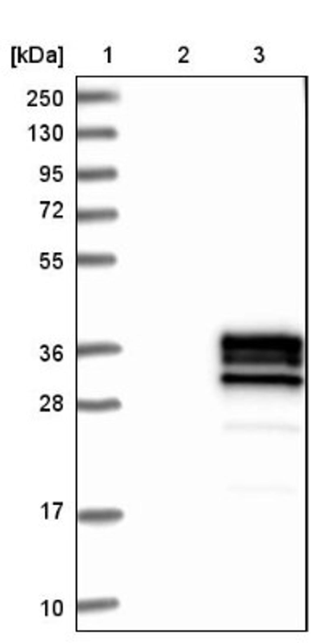 Western Blot: CD79b Antibody [NBP1-88945] - Lane 1: Marker [kDa] 250, 130, 95, 72, 55, 36, 28, 17, 10<br/>Lane 2: Negative control (vector only transfected HEK293T lysate)<br/>Lane 3: Over-expression lysate (Co-expressed with a C-terminal myc-DDK tag (~3.1 kDa) in mammalian HEK293T cells, LY421857)