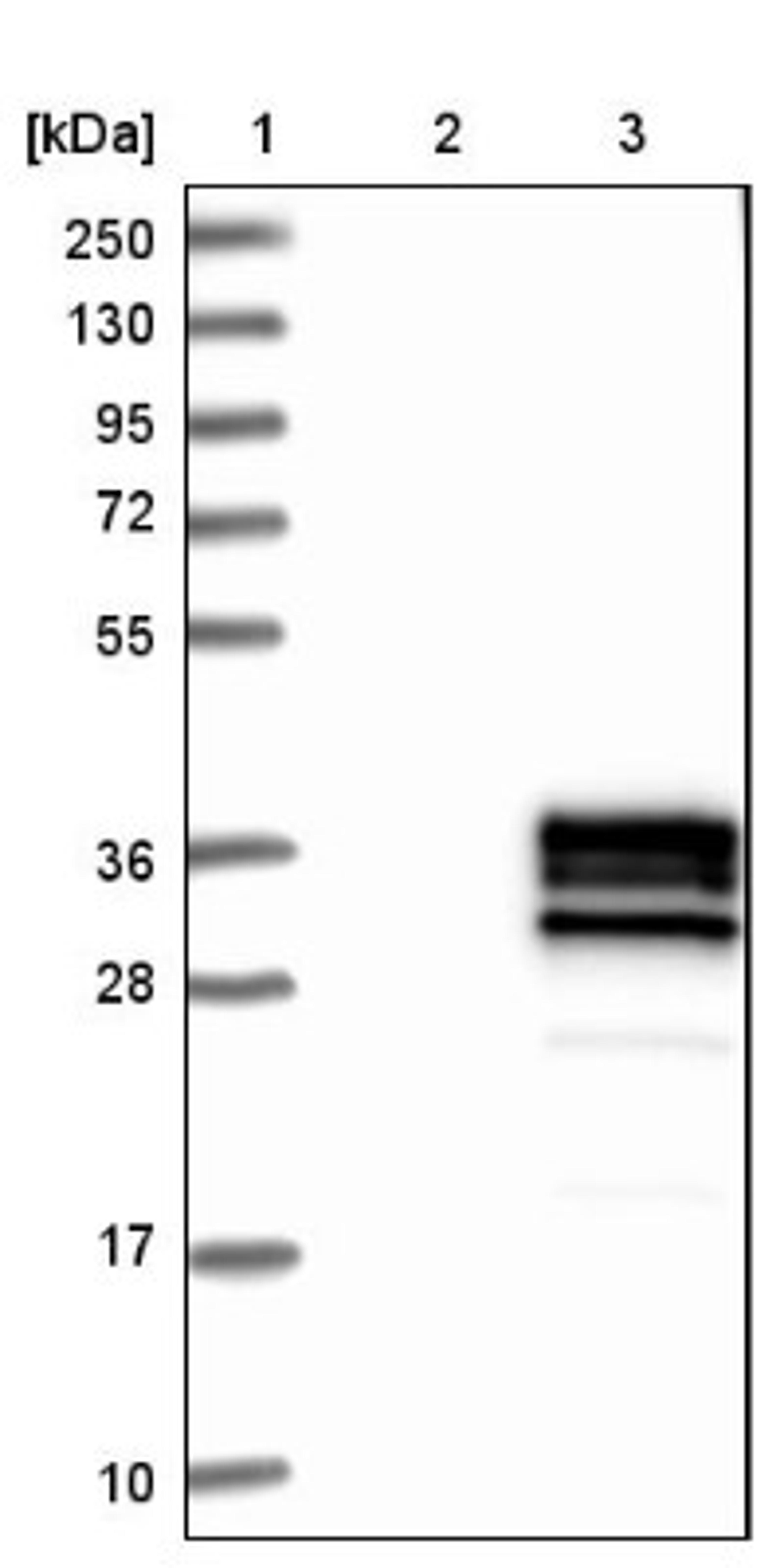 Western Blot: CD79b Antibody [NBP1-88945] - Lane 1: Marker [kDa] 250, 130, 95, 72, 55, 36, 28, 17, 10<br/>Lane 2: Negative control (vector only transfected HEK293T lysate)<br/>Lane 3: Over-expression lysate (Co-expressed with a C-terminal myc-DDK tag (~3.1 kDa) in mammalian HEK293T cells, LY421857)