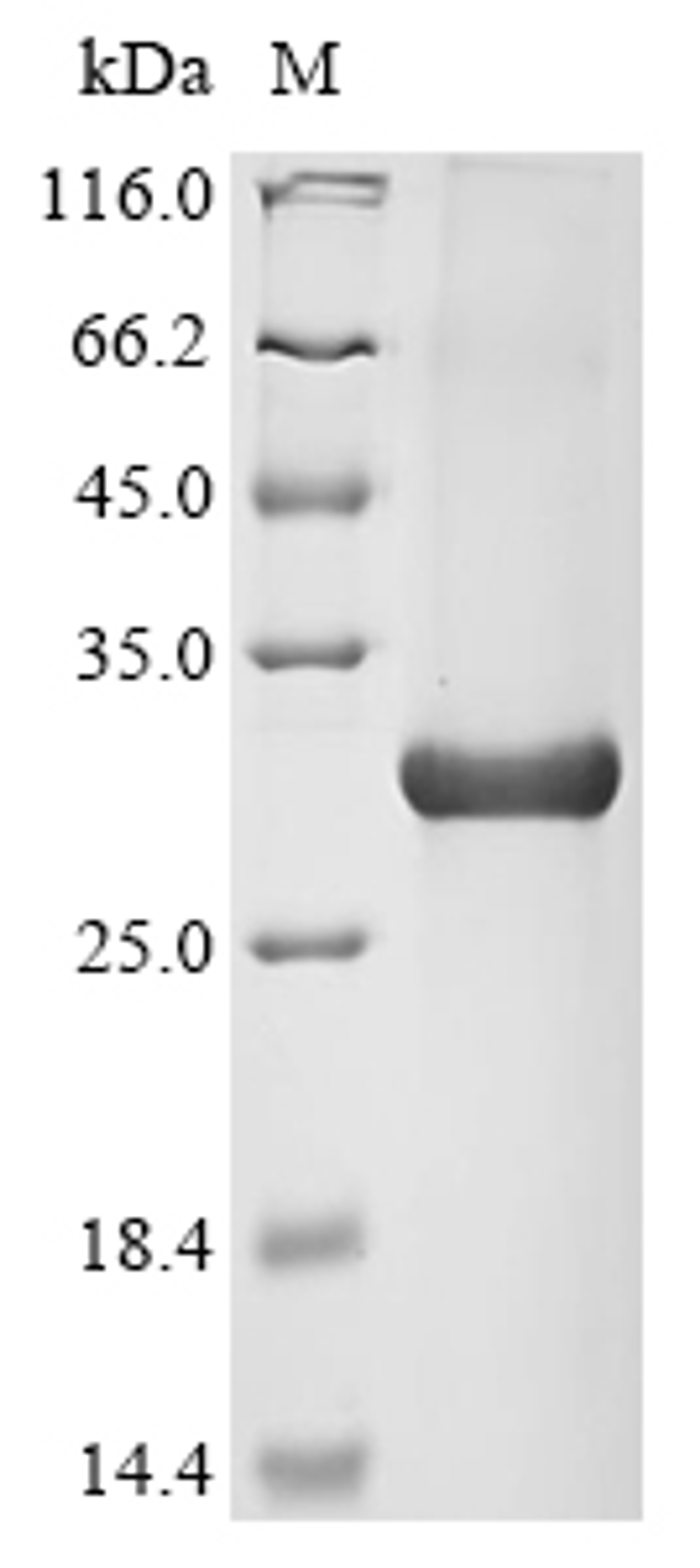 (Tris-Glycine gel) Discontinuous SDS-PAGE (reduced) with 5% enrichment gel and 15% separation gel.
