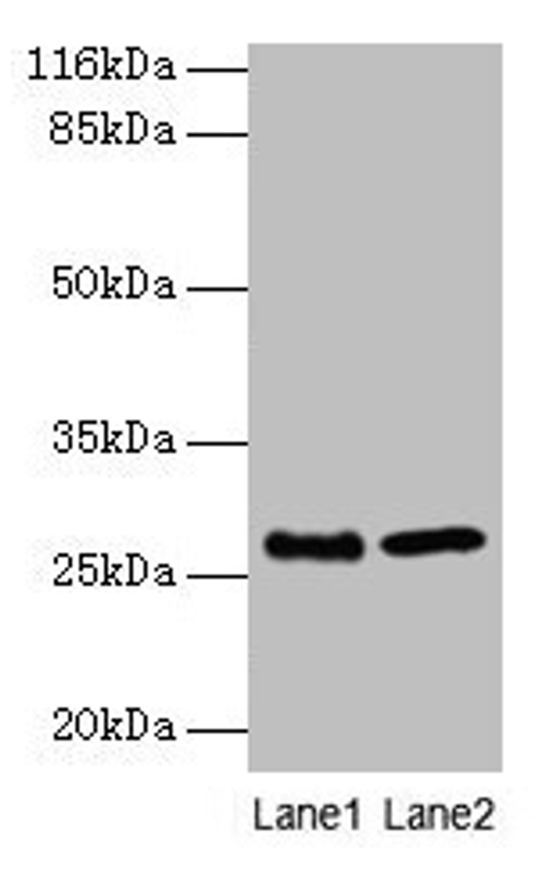 Western blot. All lanes: EBP antibody at 2µg/ml. Lane 1: A549 whole cell lysate. Lane 2: 293T whole cell lysate. Secondary. Goat polyclonal to rabbit IgG at 1/10000 dilution. Predicted band size: 27 kDa. Observed band size: 27 kDa