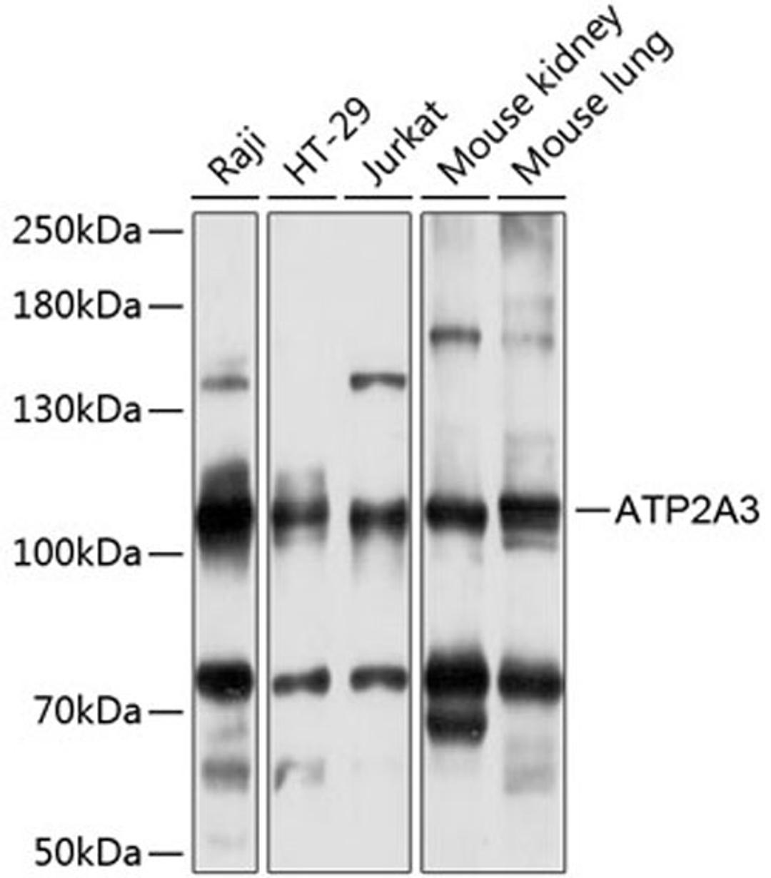 Western blot - ATP2A3 antibody (A14232)