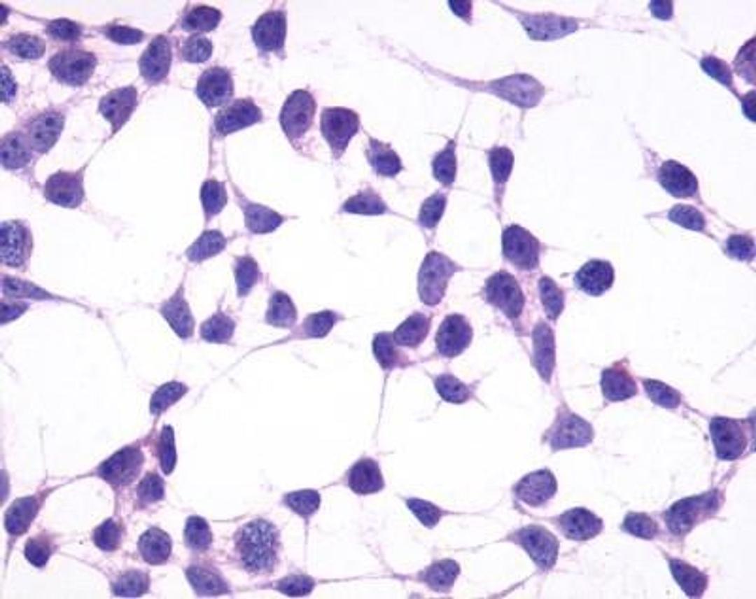 Immunocytochemistry/Immunofluorescence: GPR4 Antibody [NLS145] - Analysis of anti-GPR4 antibody with untransfected HEK293 human embryonic kidney cells.