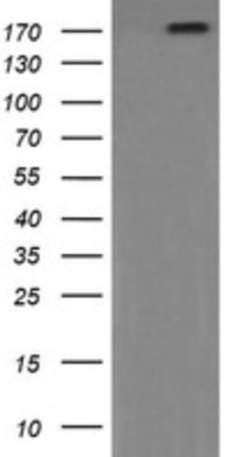 Western Blot: PI 3-Kinase C2 beta Antibody (3B1) [NBP2-46402] - Analysis of HEK293T cells were transfected with the pCMV6-ENTRY control (Left lane) or pCMV6-ENTRY PI 3-Kinase C2 beta.