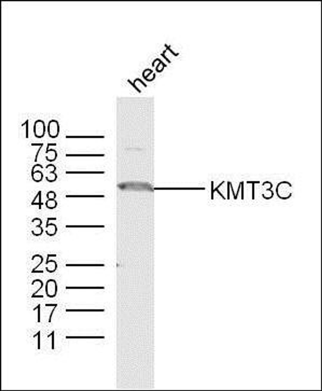 Western blot analysis of mouse Heart lysates (Lane 1) using KMT3C antibody.