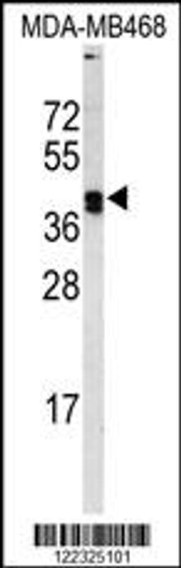 Western blot analysis of LOX Antibody in MDA-MB468 cell line lysates (35ug/lane)