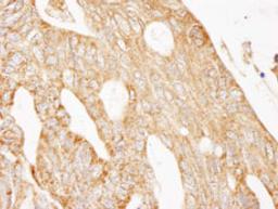 Detection of human IRS2 by immunohistochemistry.