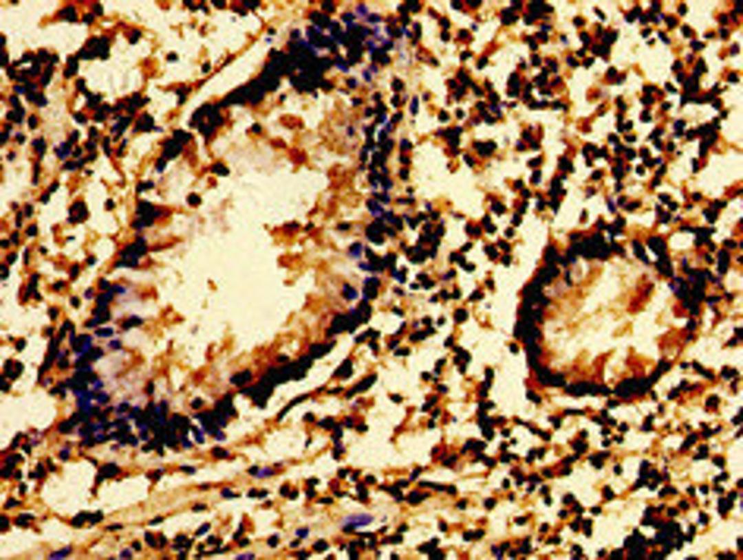 Immunohistochemistry of paraffin-embedded human appendix tissue using CSB-PA022998LA01HU at dilution of 1:100