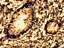 Immunohistochemistry of paraffin-embedded human appendix tissue using CSB-PA022998LA01HU at dilution of 1:100