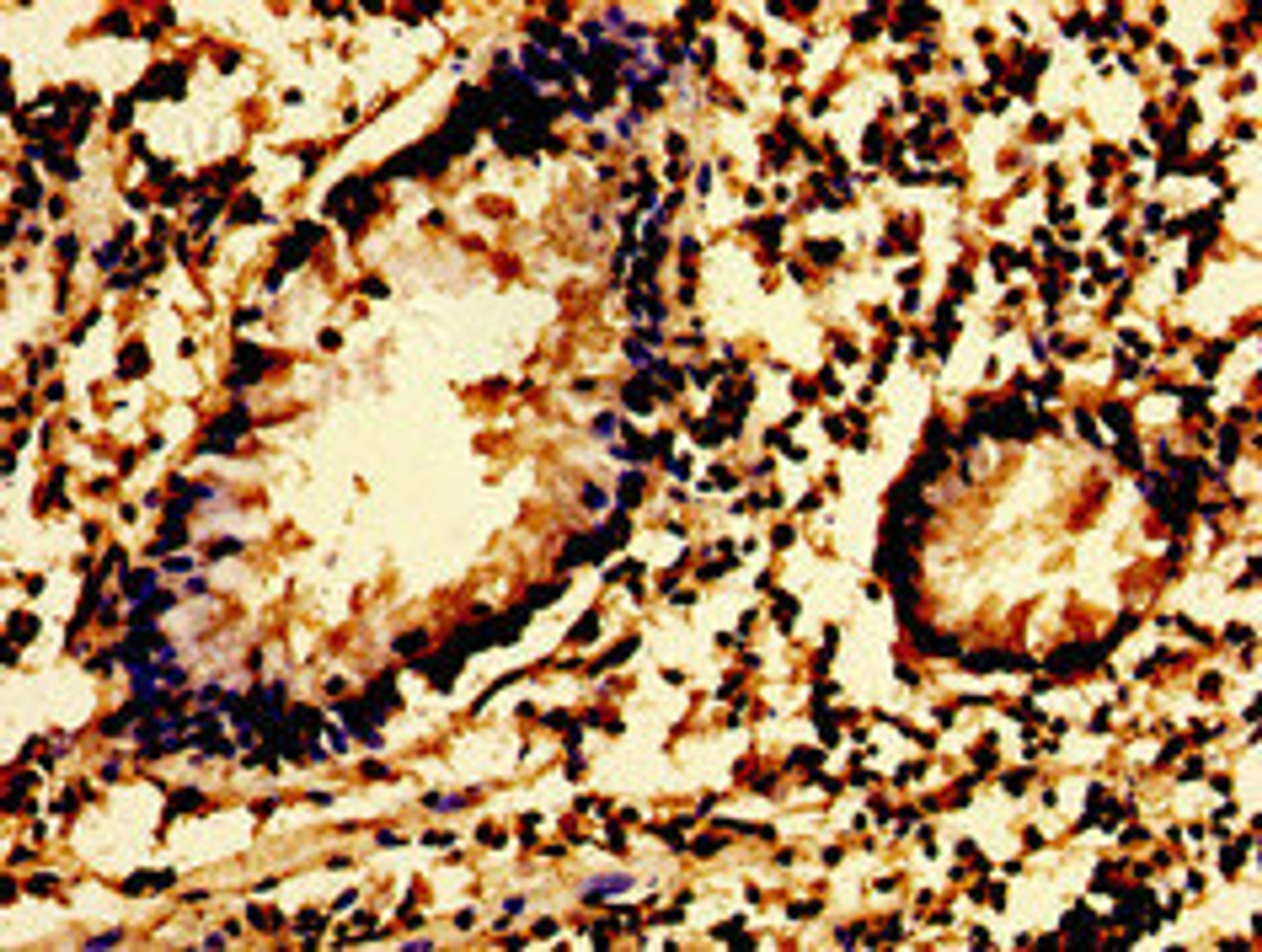 Immunohistochemistry of paraffin-embedded human appendix tissue using CSB-PA022998LA01HU at dilution of 1:100