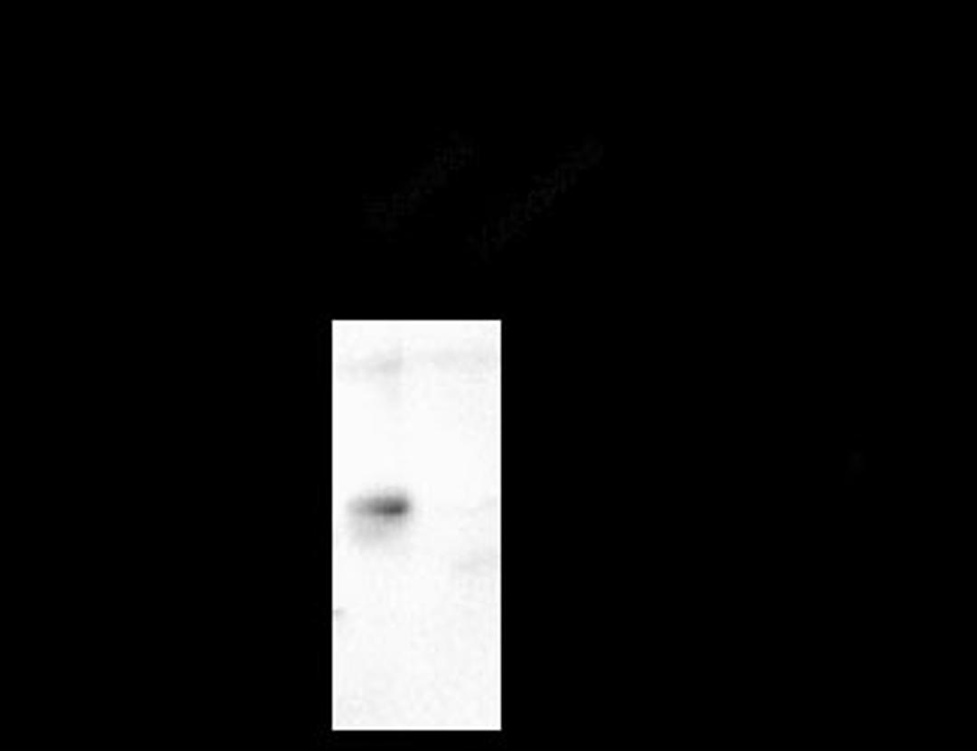 GABA A Receptor alpha 6, CT Antibody