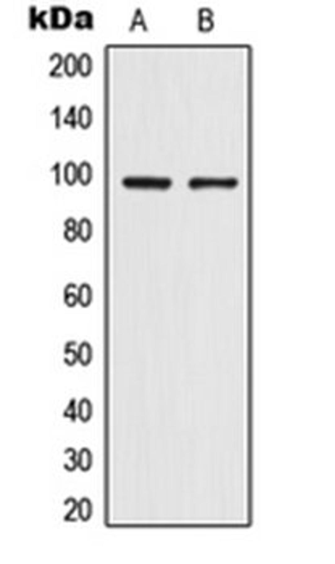 Western blot analysis of HepG2 (Lane 1), HeLa (Lane 2) whole cell lysates using TRPV4 antibody