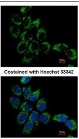 Immunocytochemistry/Immunofluorescence: Cannabinoid R2/CB2/CNR2 Antibody [NBP2-15689] - Analysis of methanol-fixed A431.