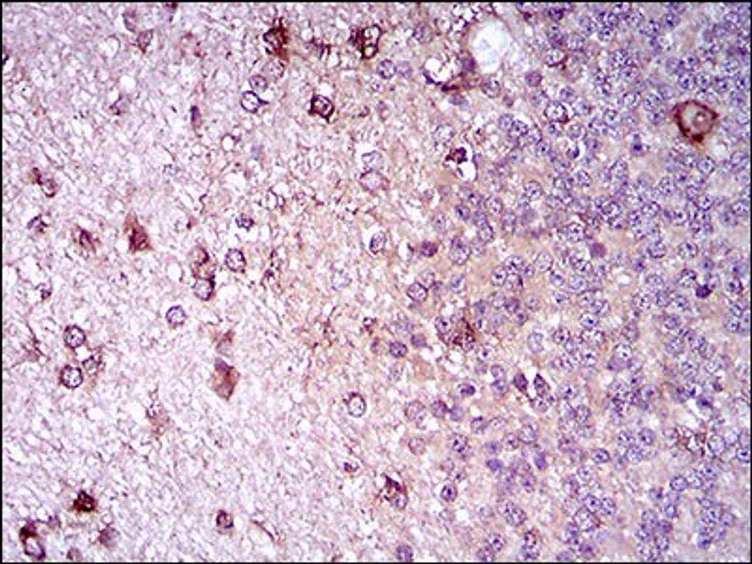 Immunohistochemistry: Siglec-2/CD22 Antibody (2H1C4) [NBP2-37327] - Immunohistochemical analysis of paraffin-embedded cerebellum tissues using ZEB1 mouse mAb with DAB staining.