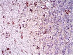 Immunohistochemistry: Siglec-2/CD22 Antibody (2H1C4) [NBP2-37327] - Immunohistochemical analysis of paraffin-embedded cerebellum tissues using ZEB1 mouse mAb with DAB staining.