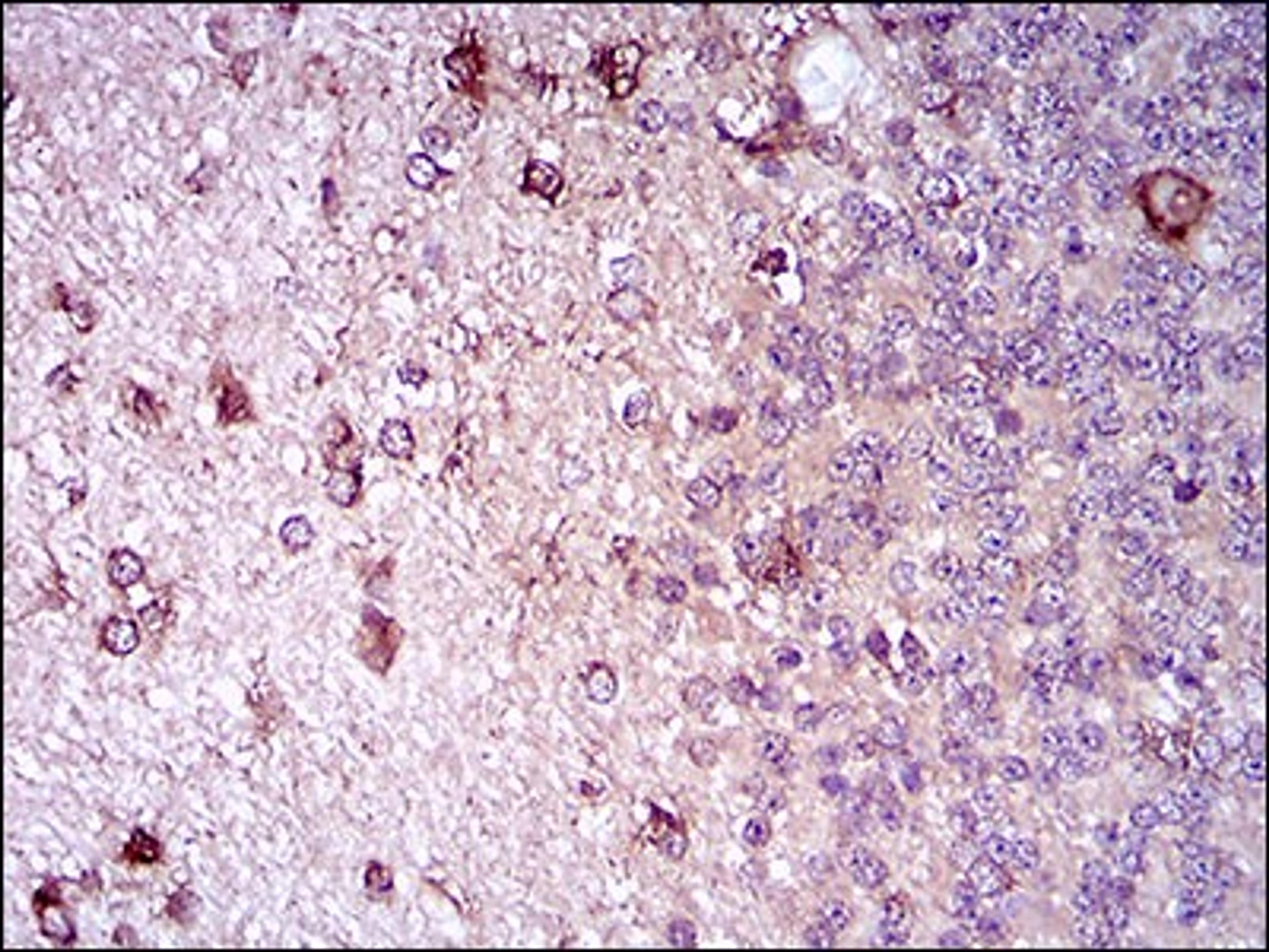 Immunohistochemistry: Siglec-2/CD22 Antibody (2H1C4) [NBP2-37327] - Immunohistochemical analysis of paraffin-embedded cerebellum tissues using ZEB1 mouse mAb with DAB staining.