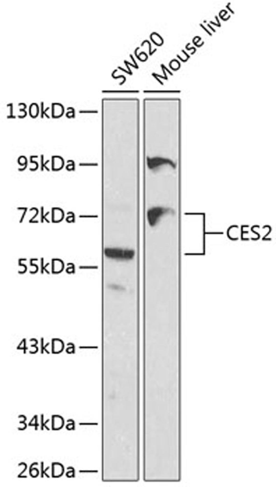 Western blot - CES2 antibody (A1514)