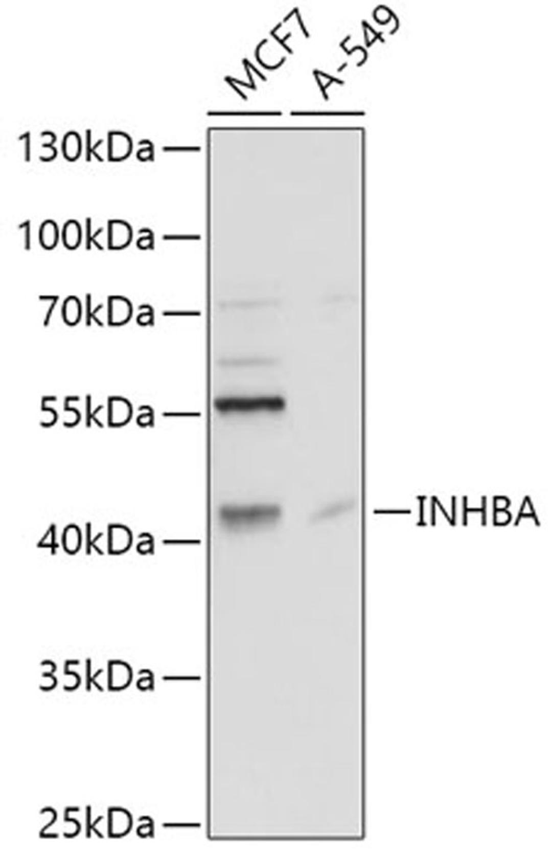 Western blot - INHBA antibody (A5837)