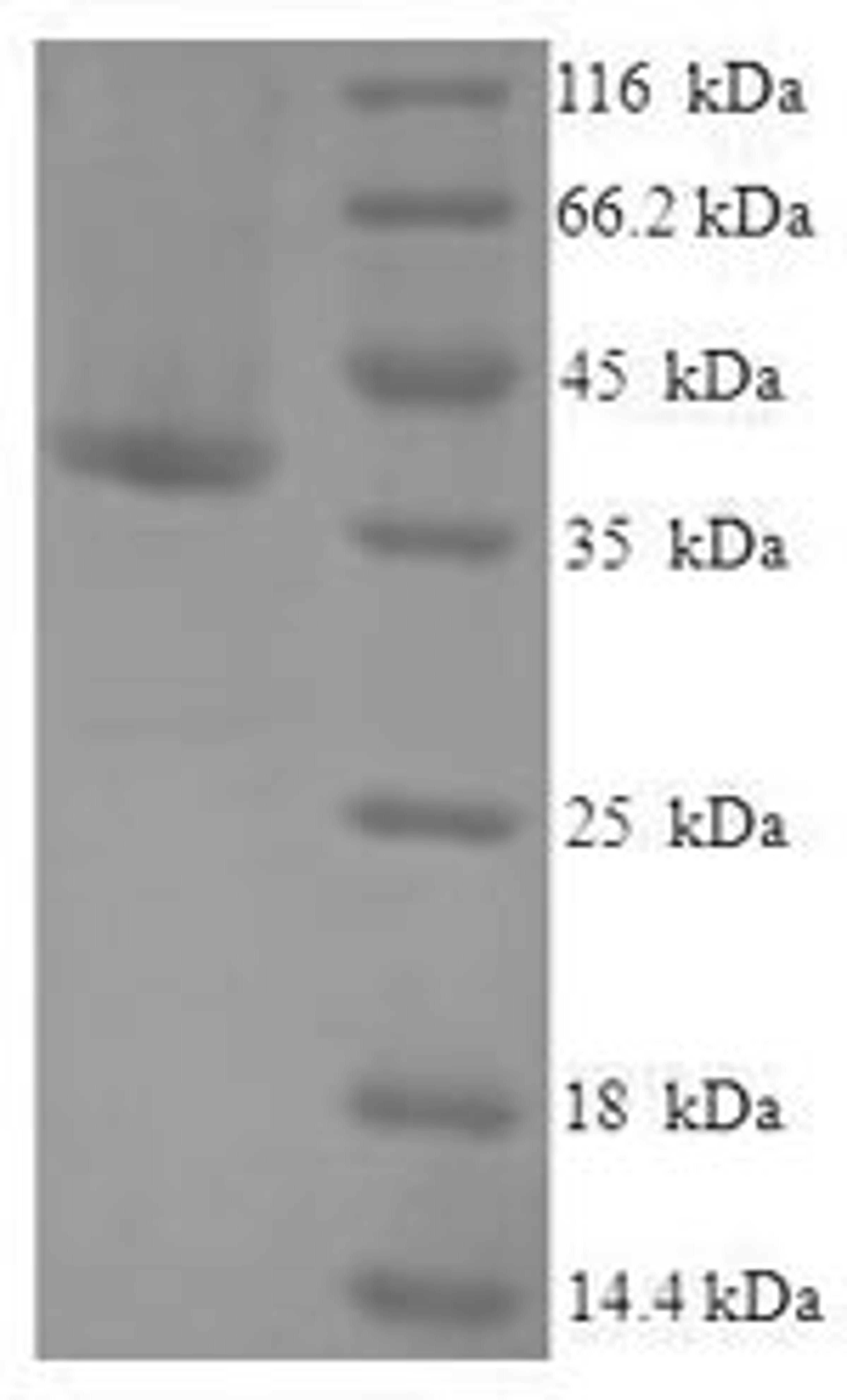 (Tris-Glycine gel) Discontinuous SDS-PAGE (reduced) with 5% enrichment gel and 15% separation gel.