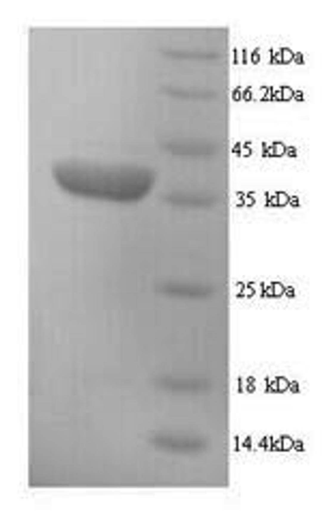 (Tris-Glycine gel) Discontinuous SDS-PAGE (reduced) with 5% enrichment gel and 15% separation gel.