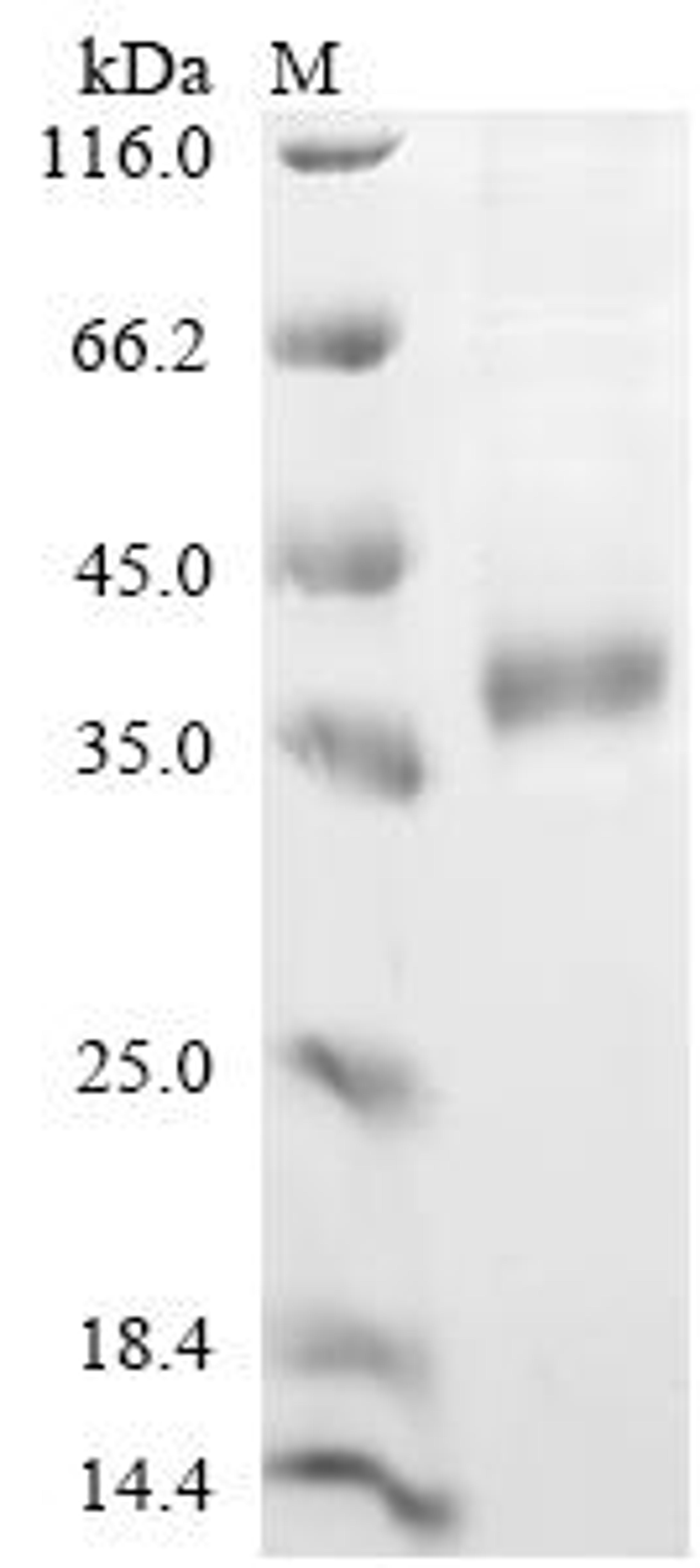 (Tris-Glycine gel) Discontinuous SDS-PAGE (reduced) with 5% enrichment gel and 15% separation gel.