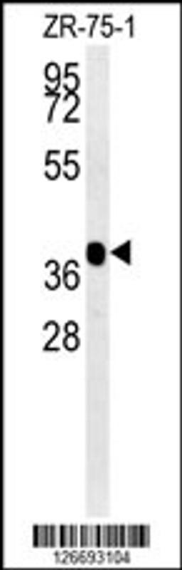 Western blot analysis in ZR-75-1 cell line lysates (35ug/lane).This demonstrates the detected NIPAL2 protein (arrow).