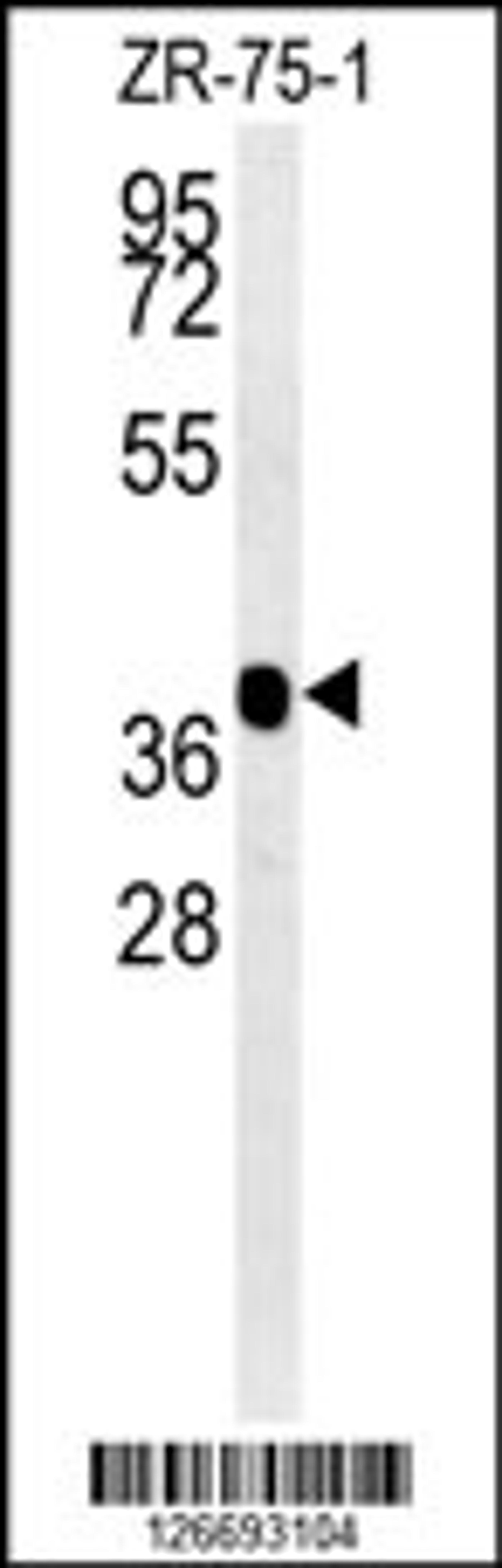 Western blot analysis in ZR-75-1 cell line lysates (35ug/lane).This demonstrates the detected NIPAL2 protein (arrow).