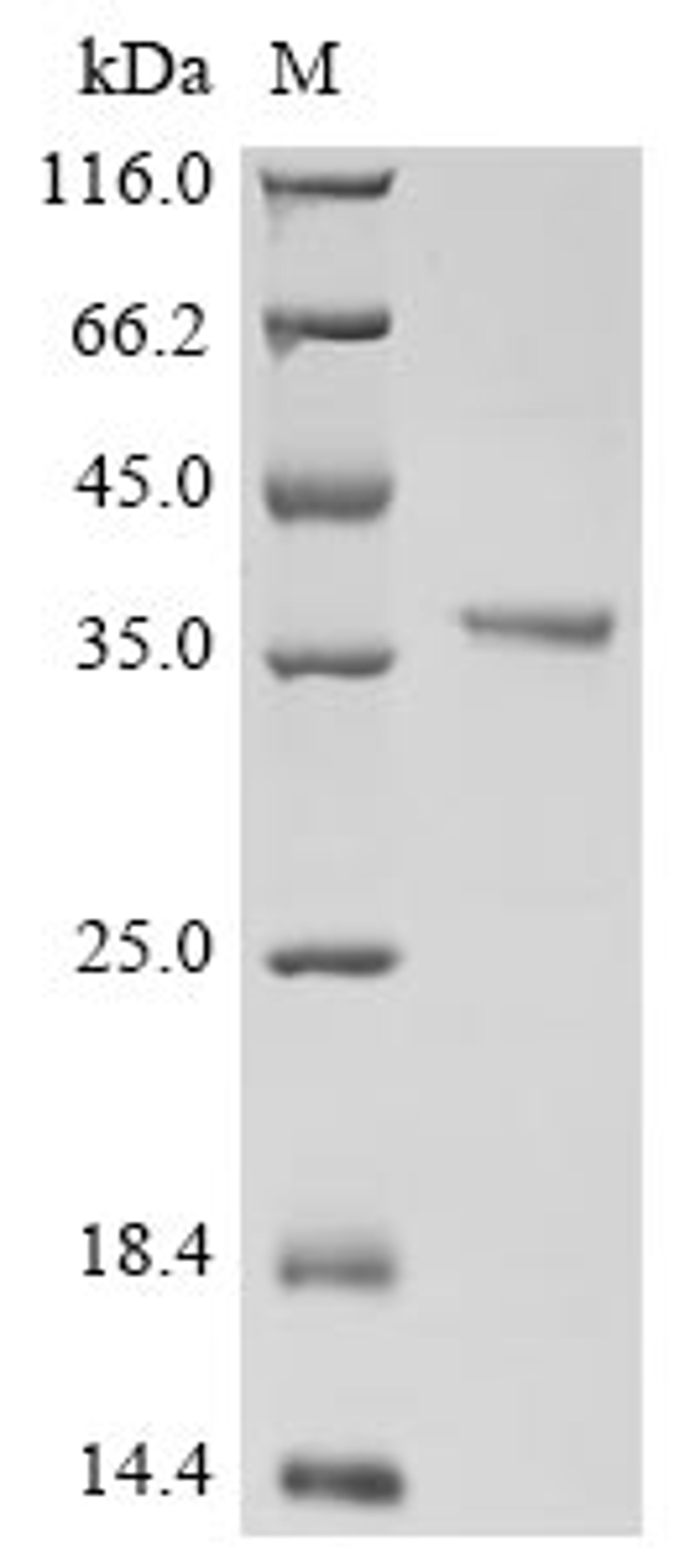 (Tris-Glycine gel) Discontinuous SDS-PAGE (reduced) with 5% enrichment gel and 15% separation gel.