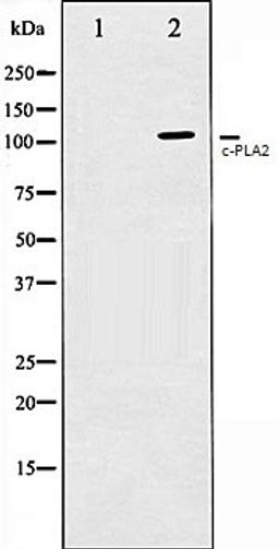 Western blot analysis of HeLa whole cell lysates using c-PLA2 antibody, The lane on the left is treated with the antigen-specific peptide.