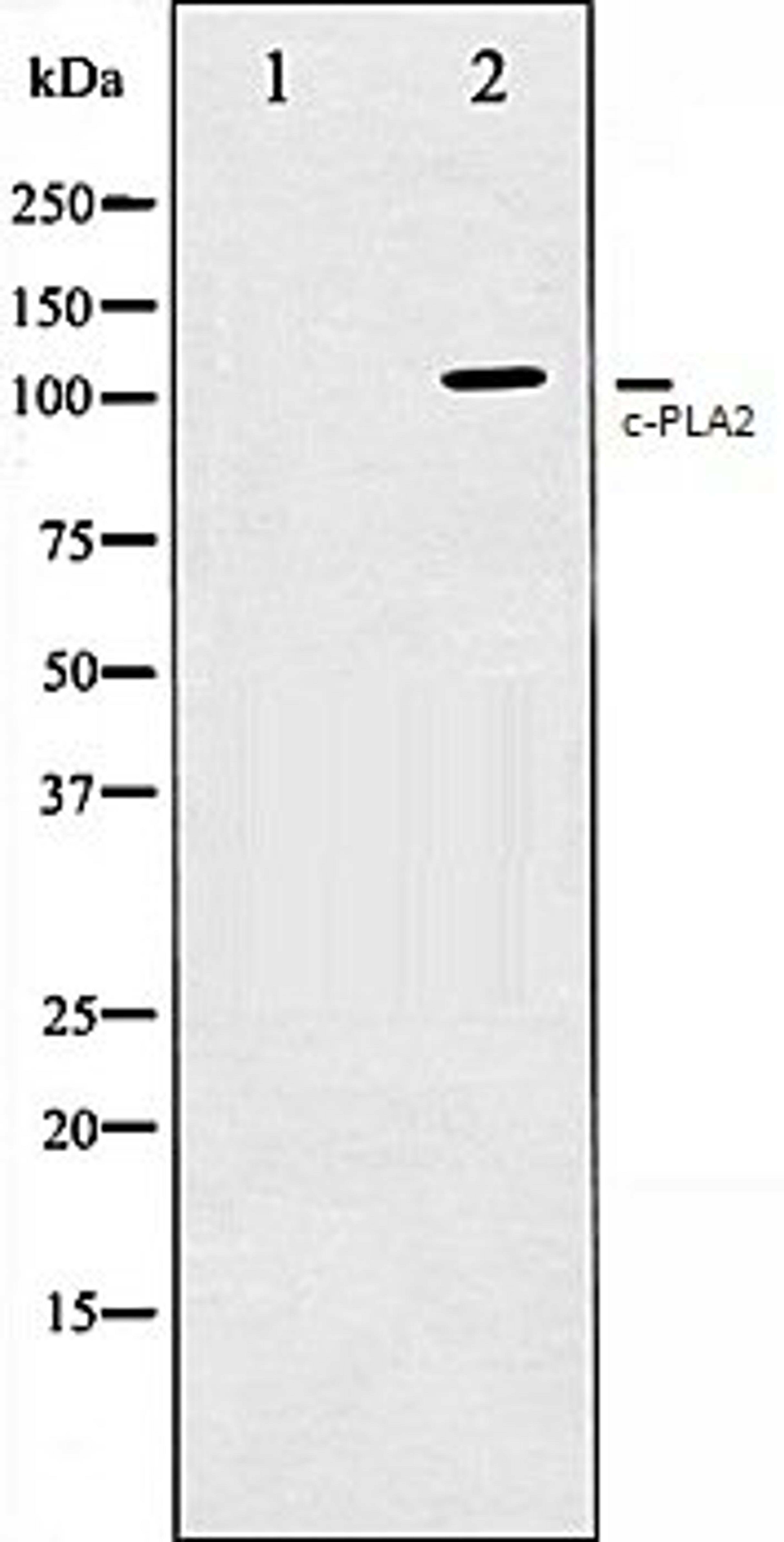 Western blot analysis of HeLa whole cell lysates using c-PLA2 antibody, The lane on the left is treated with the antigen-specific peptide.