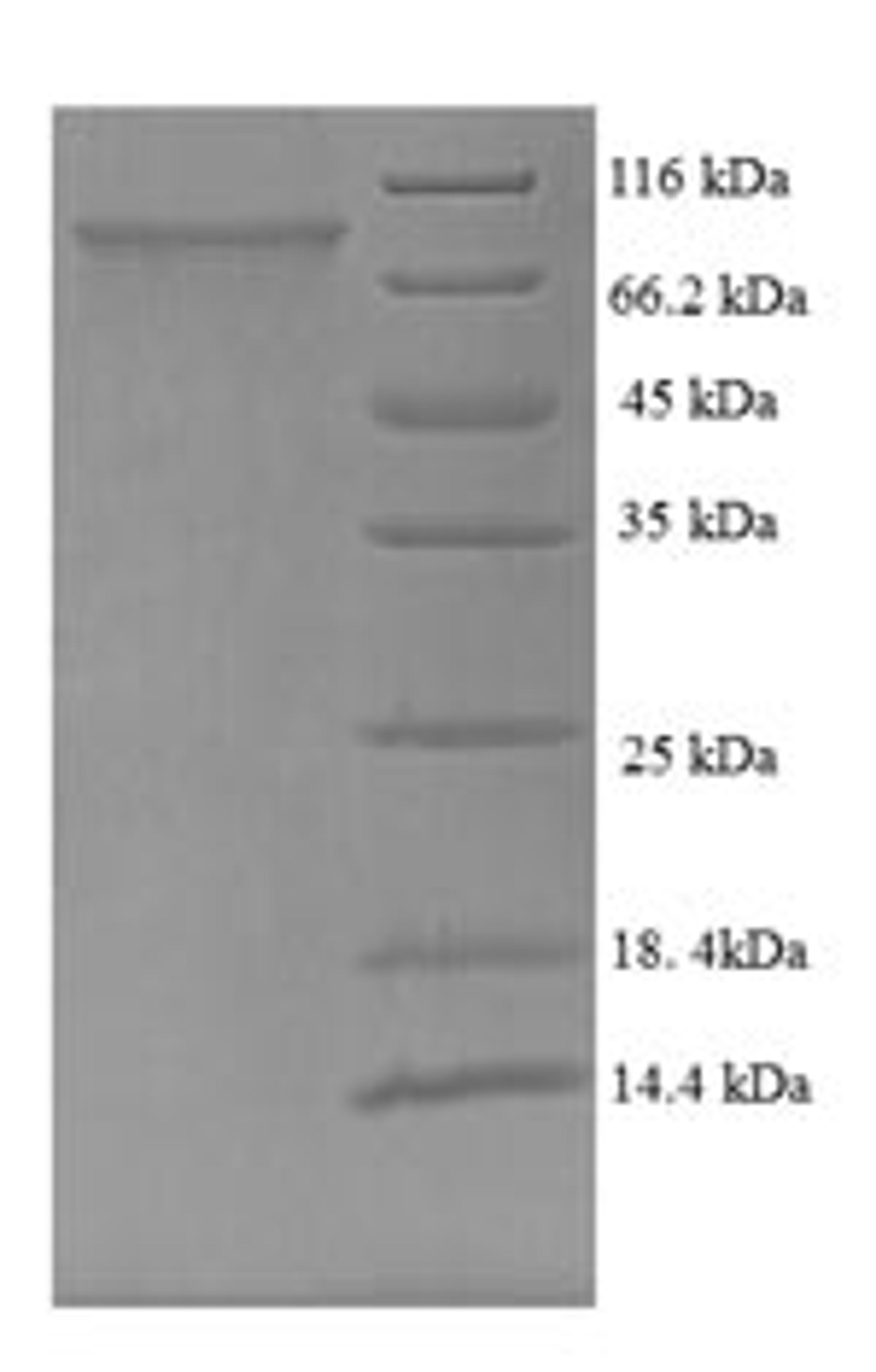 (Tris-Glycine gel) Discontinuous SDS-PAGE (reduced) with 5% enrichment gel and 15% separation gel.