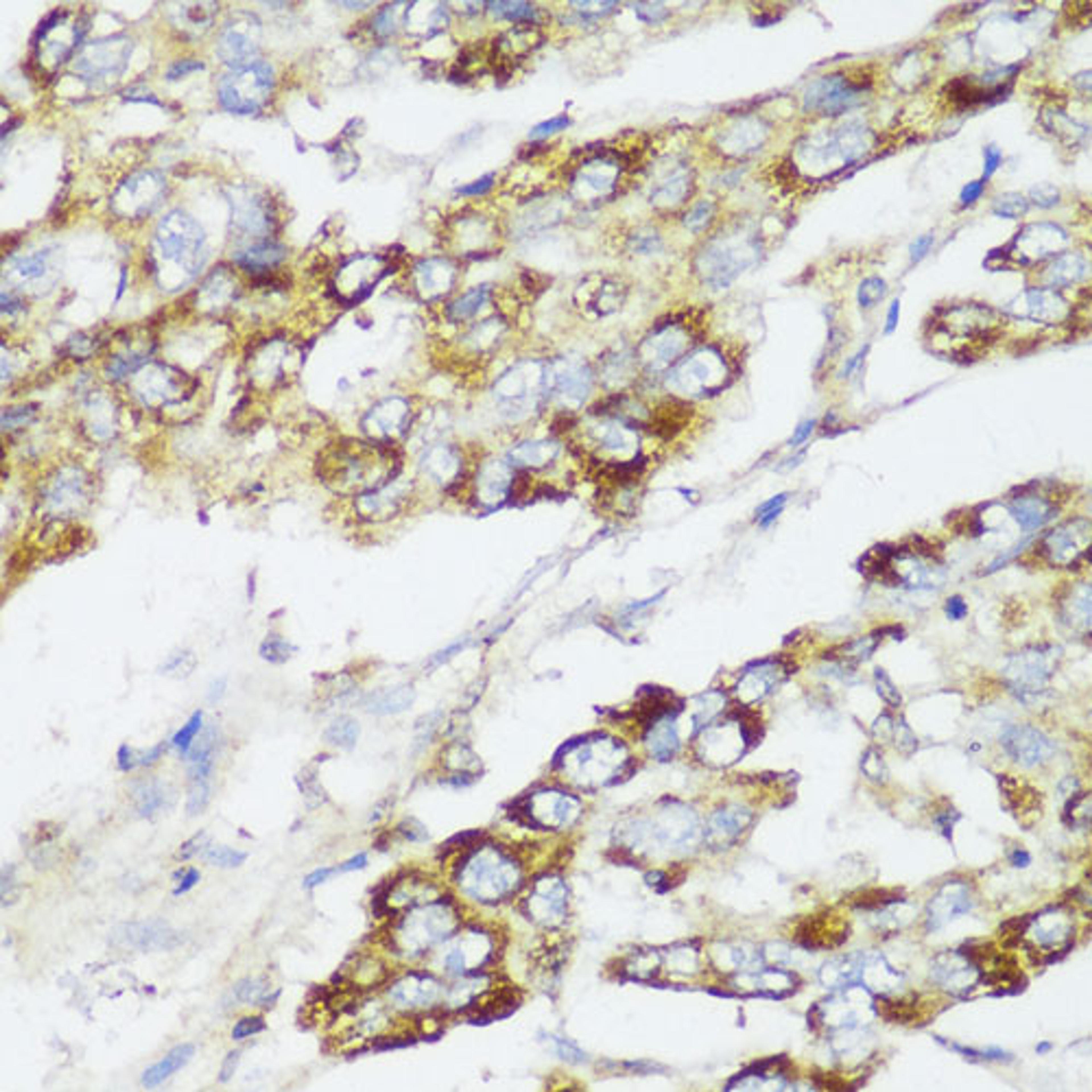 Immunohistochemistry  - ECI2 antibody (A13072)