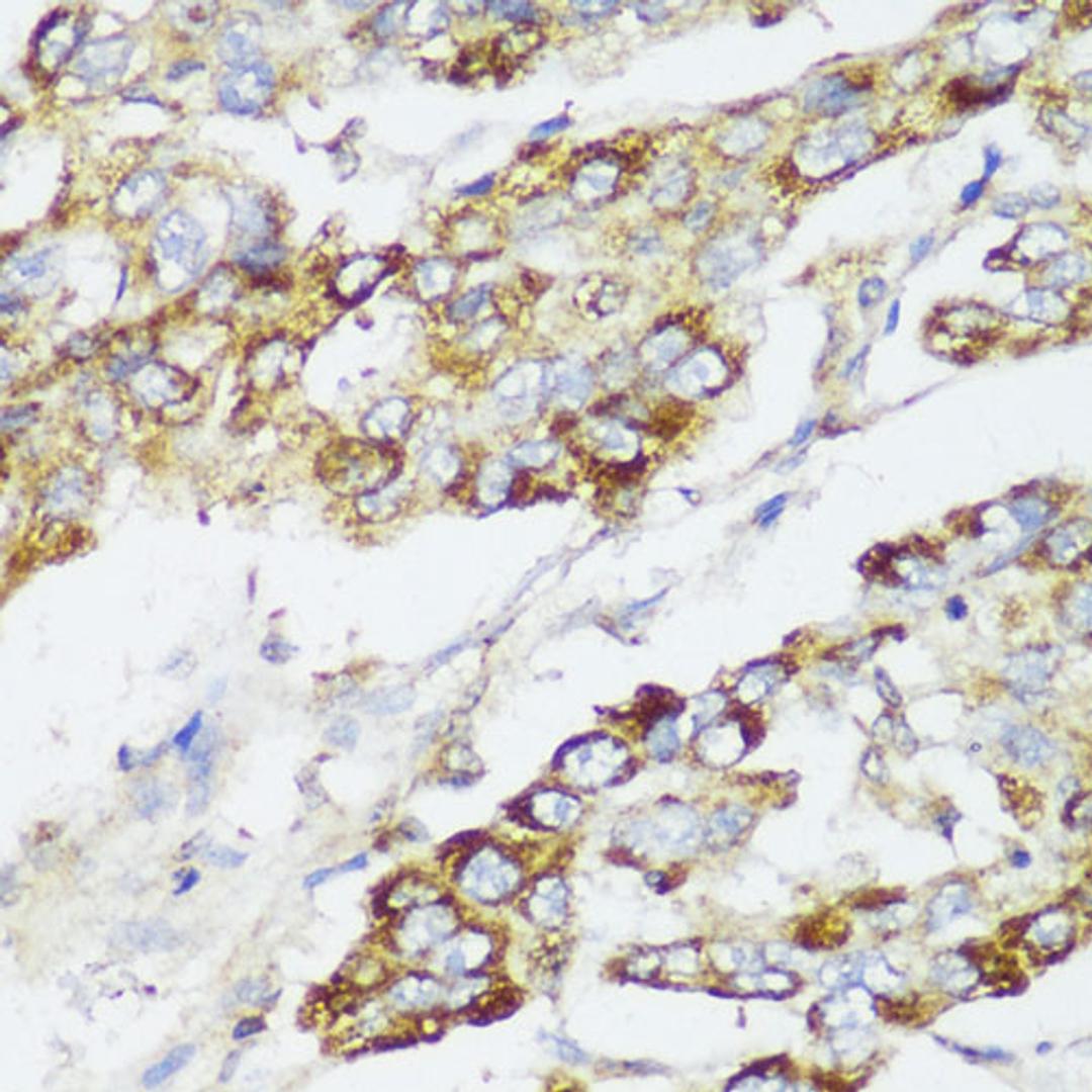 Immunohistochemistry - ECI2 antibody (A13072)