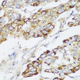 Immunohistochemistry - ECI2 antibody (A13072)
