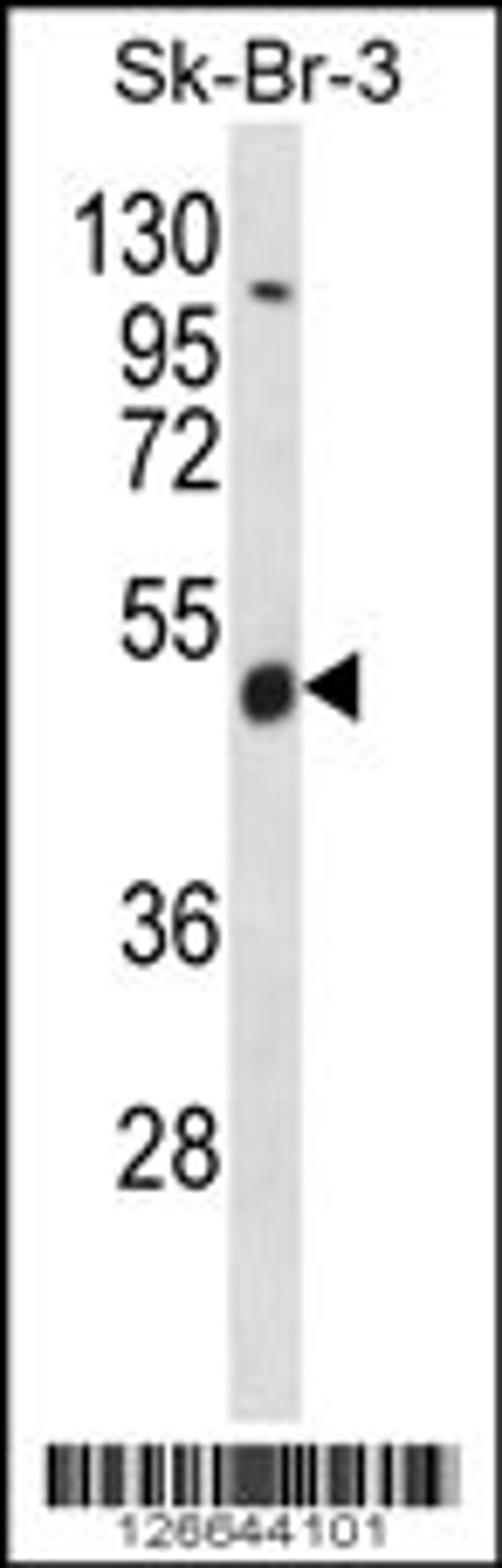 Western blot analysis in SK-BR-3 cell line lysates (35ug/lane).