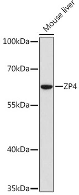 Western blot - ZP4 Rabbit pAb (A15180)