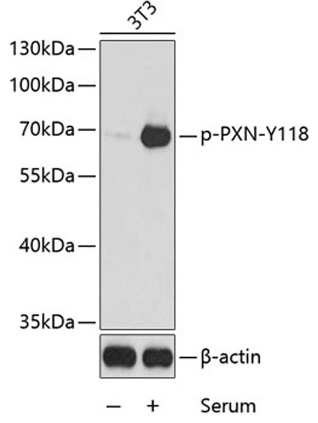 Western blot - phospho-PXN-Y118 antibody (AP0156)