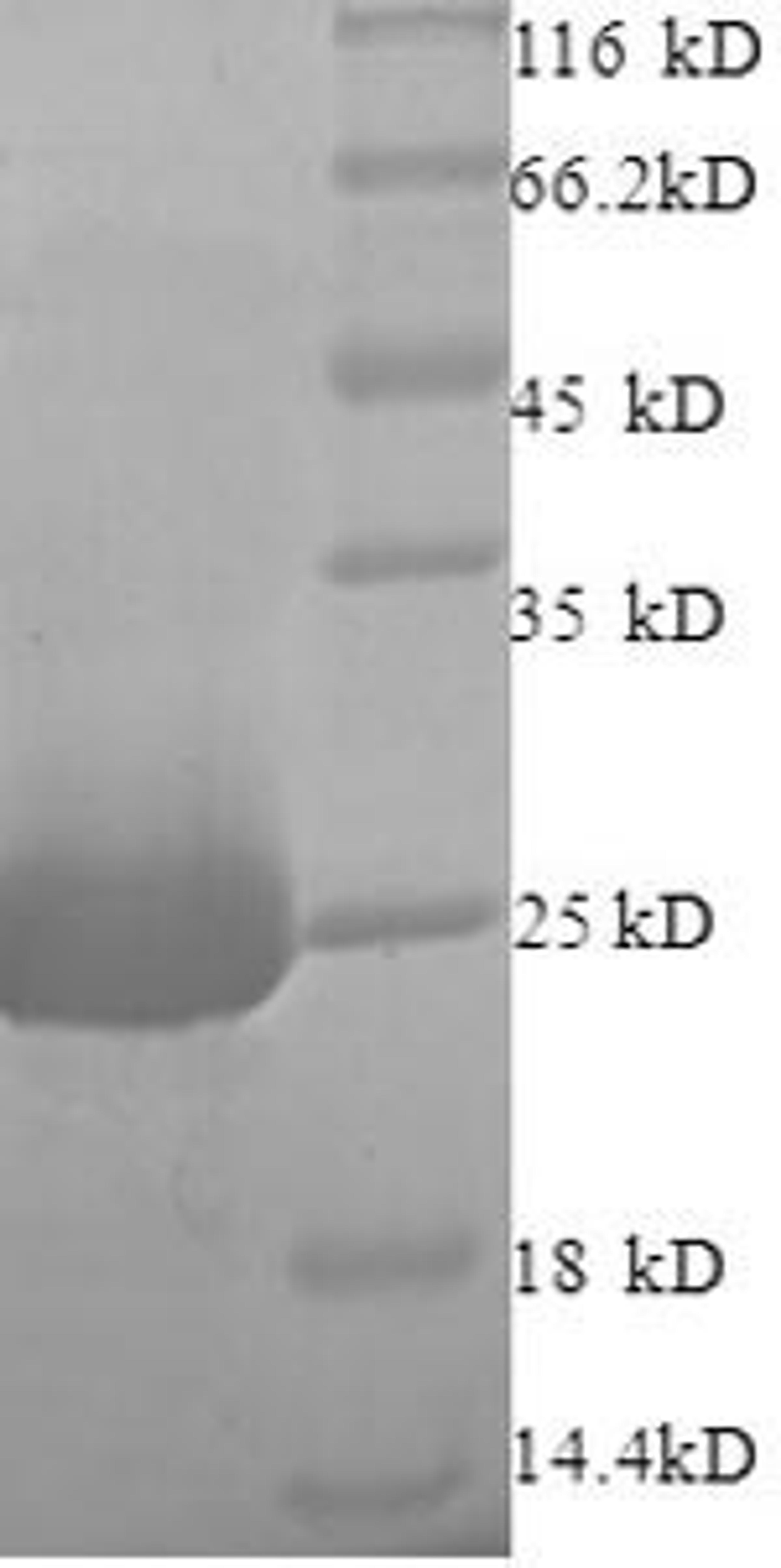 (Tris-Glycine gel) Discontinuous SDS-PAGE (reduced) with 5% enrichment gel and 15% separation gel.