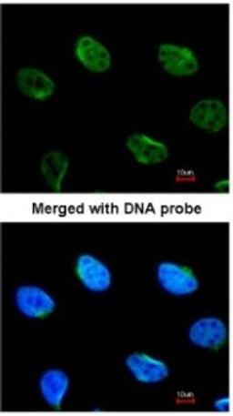 Immunocytochemistry/Immunofluorescence: Mus81 Antibody [NBP1-32054] - Paraformaldehyde-fixed HeLa, using antibody at 1:100 dilution.