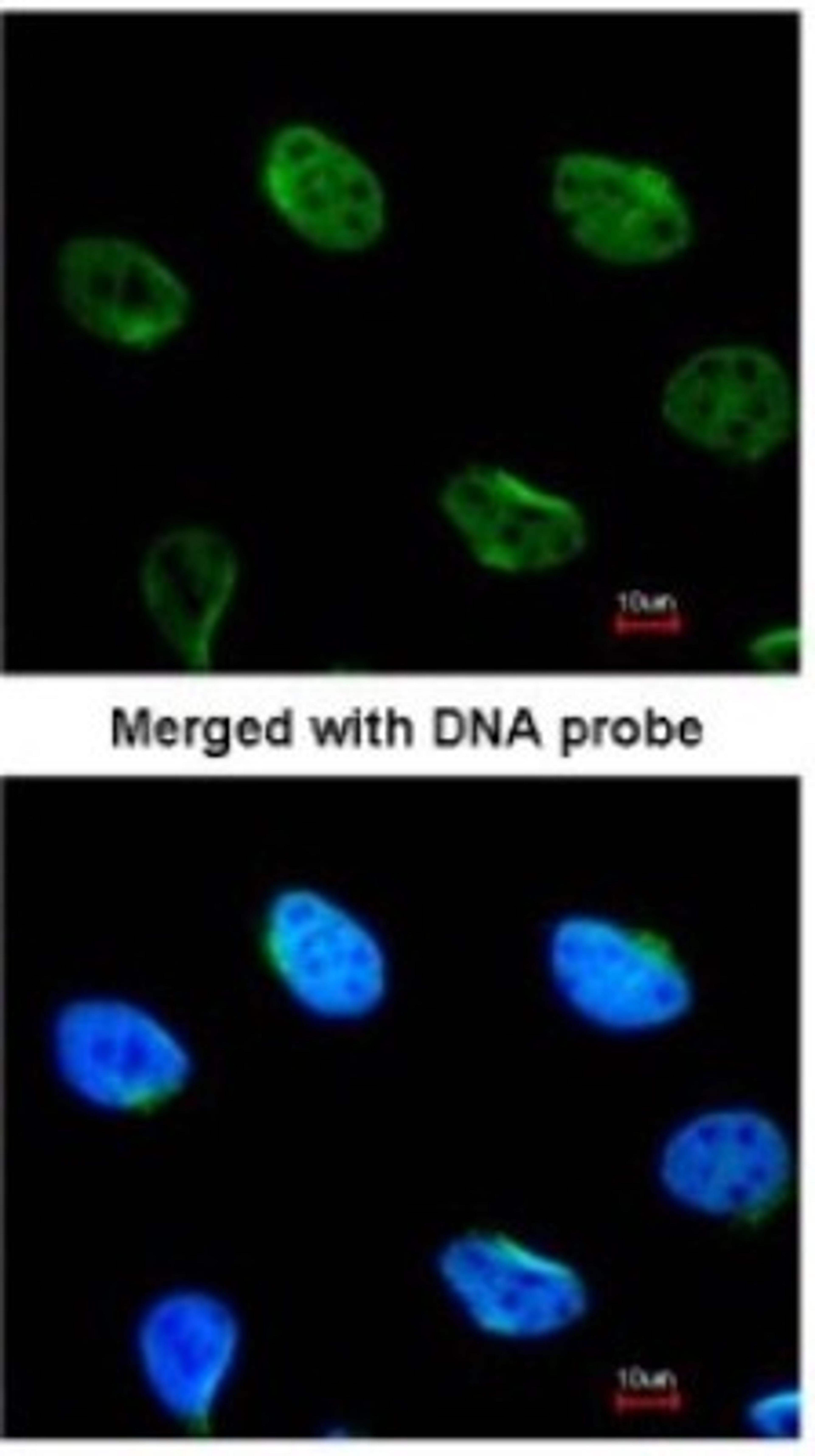 Immunocytochemistry/Immunofluorescence: Mus81 Antibody [NBP1-32054] - Paraformaldehyde-fixed HeLa, using antibody at 1:100 dilution.